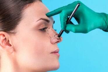 Est-ce que c’est possible d’affiner son nez sans chirurgie ? Guide et solutions alternatives