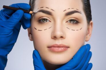 Chirurgie esthétique en Tunisie pour une réduction des rides autour des yeux